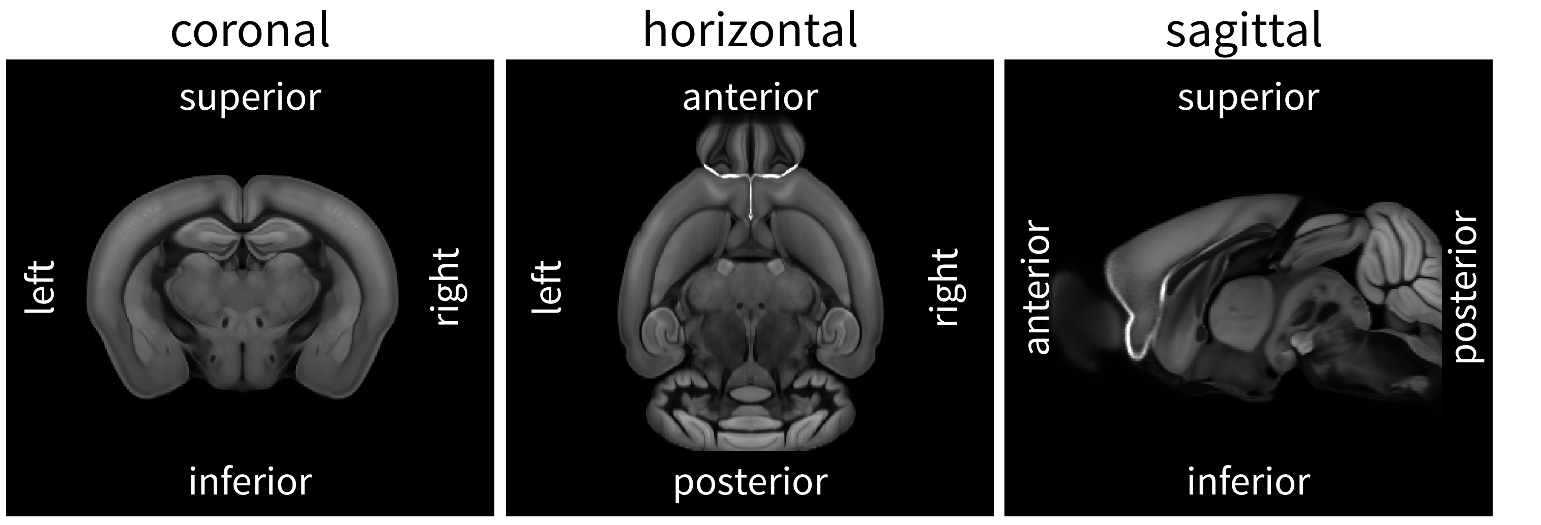 allen mouse atlas 50μm