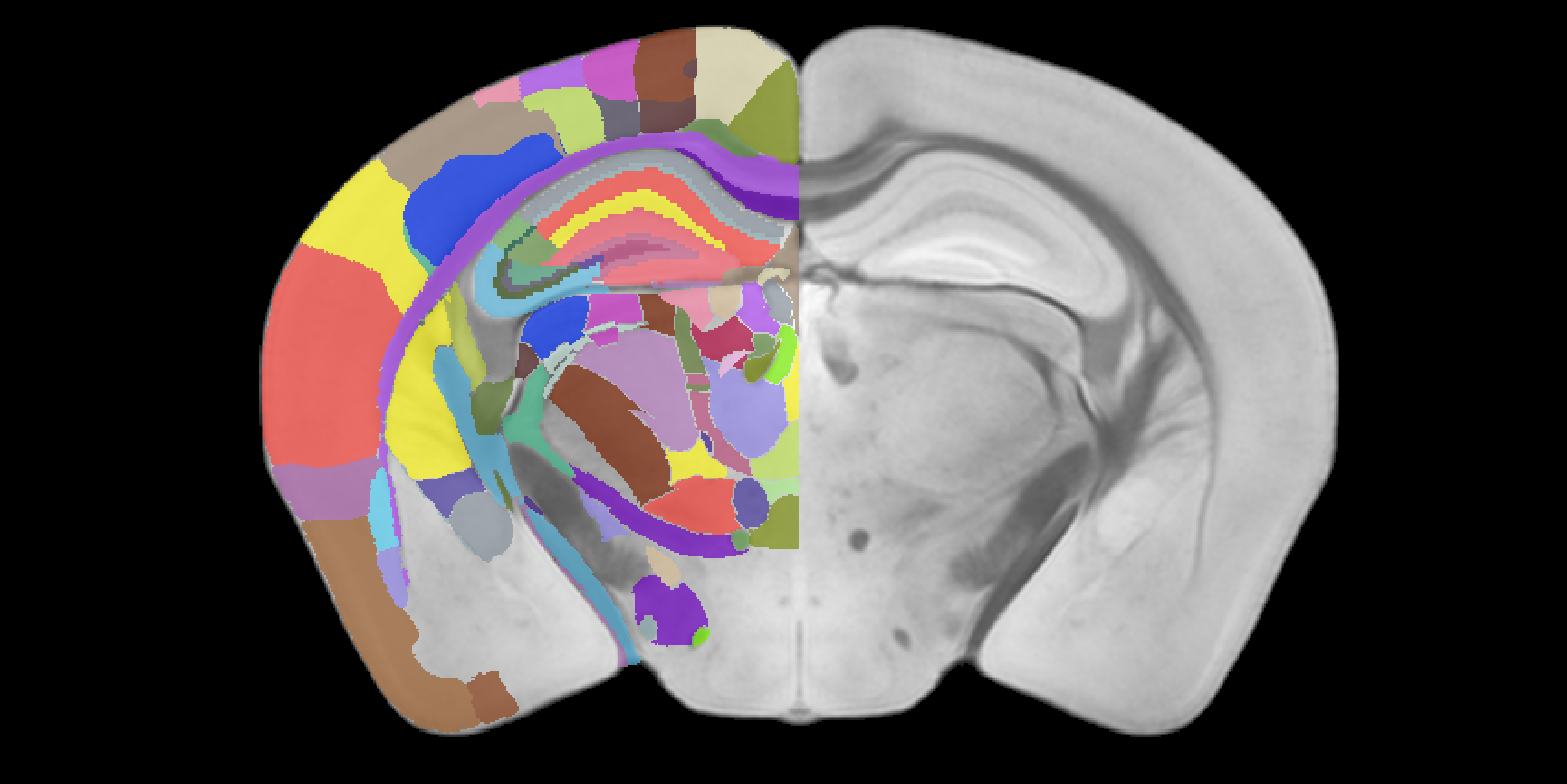 A coronal section of the Australian mouse brain