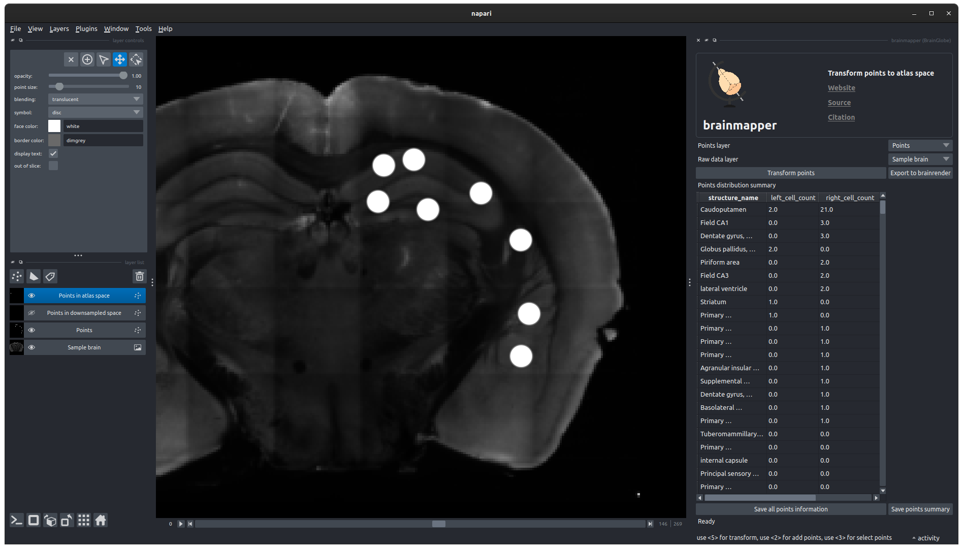 brainmapper results