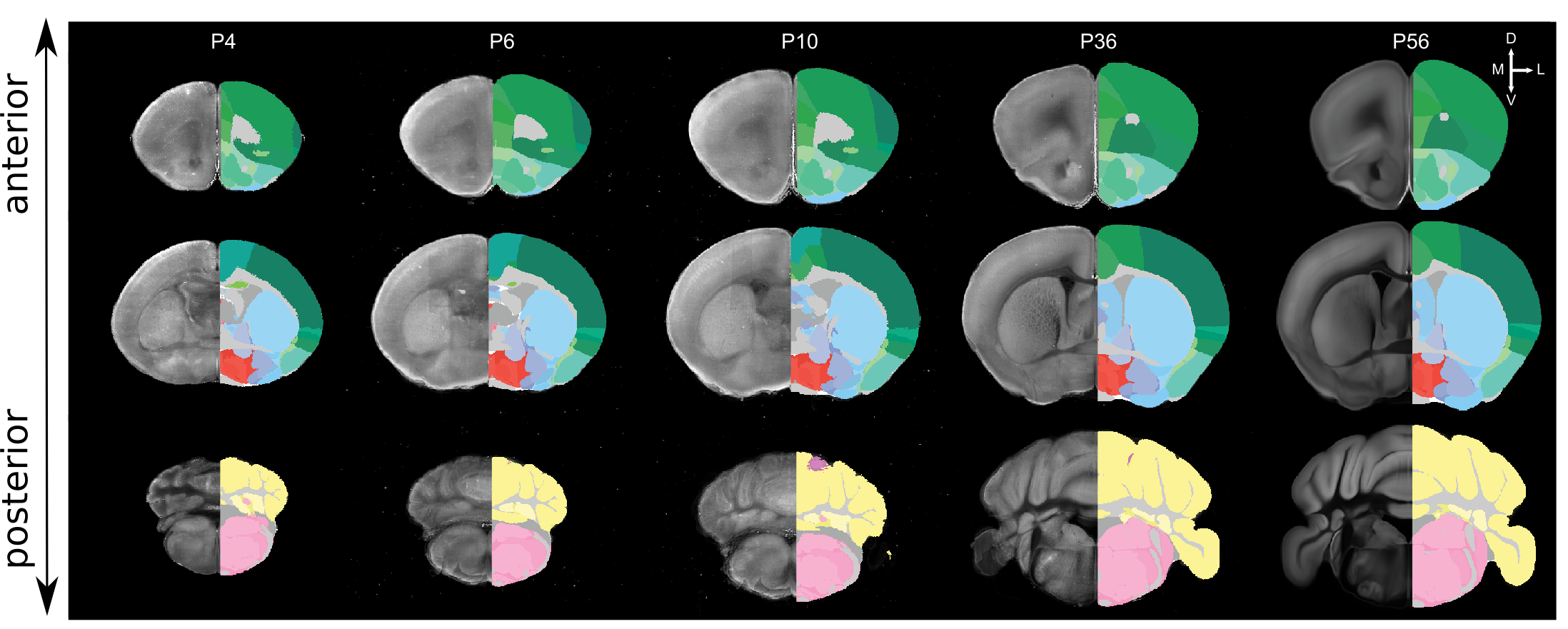 Coronal views of the demba atlas at different timepoints