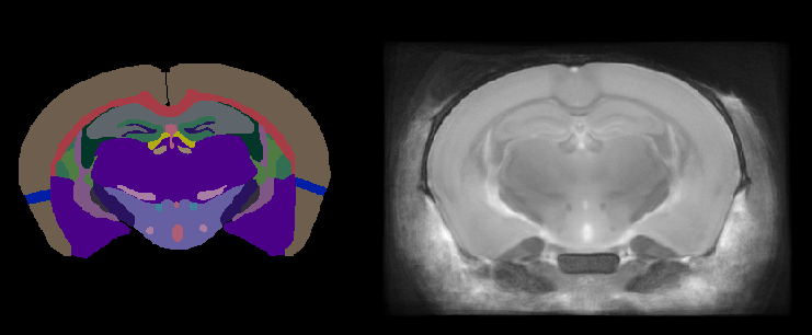 Dorr atlas annotations