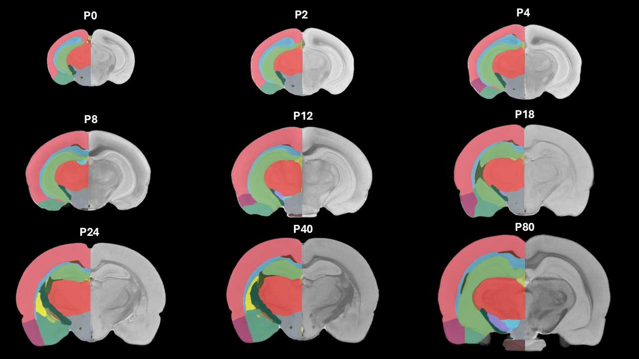 duke dev rat brain atlas annotations