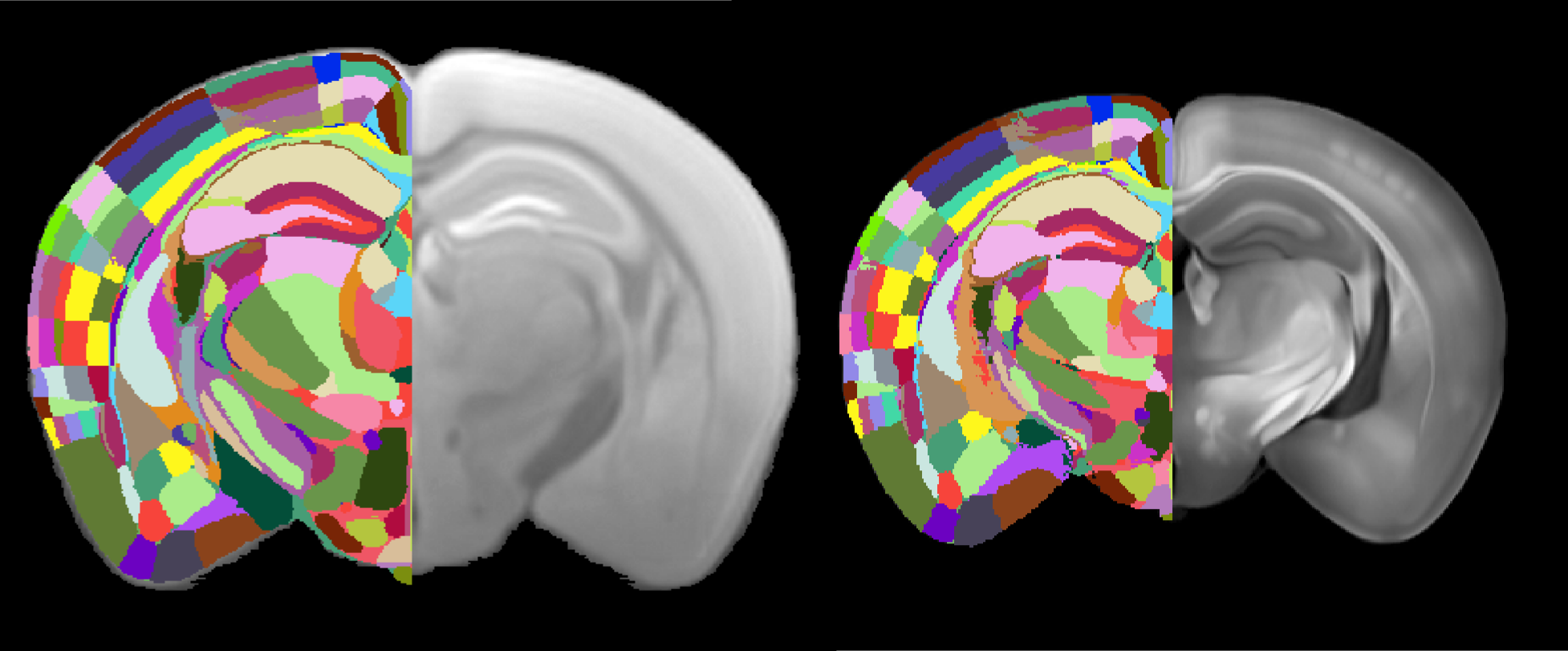 Templates and annotations of the Gubra multimodal brain atlas