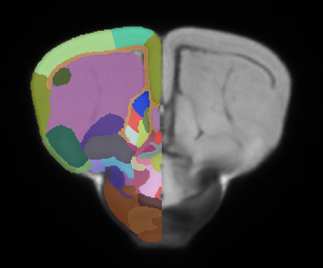 Tawny dragon brain atlas annotations