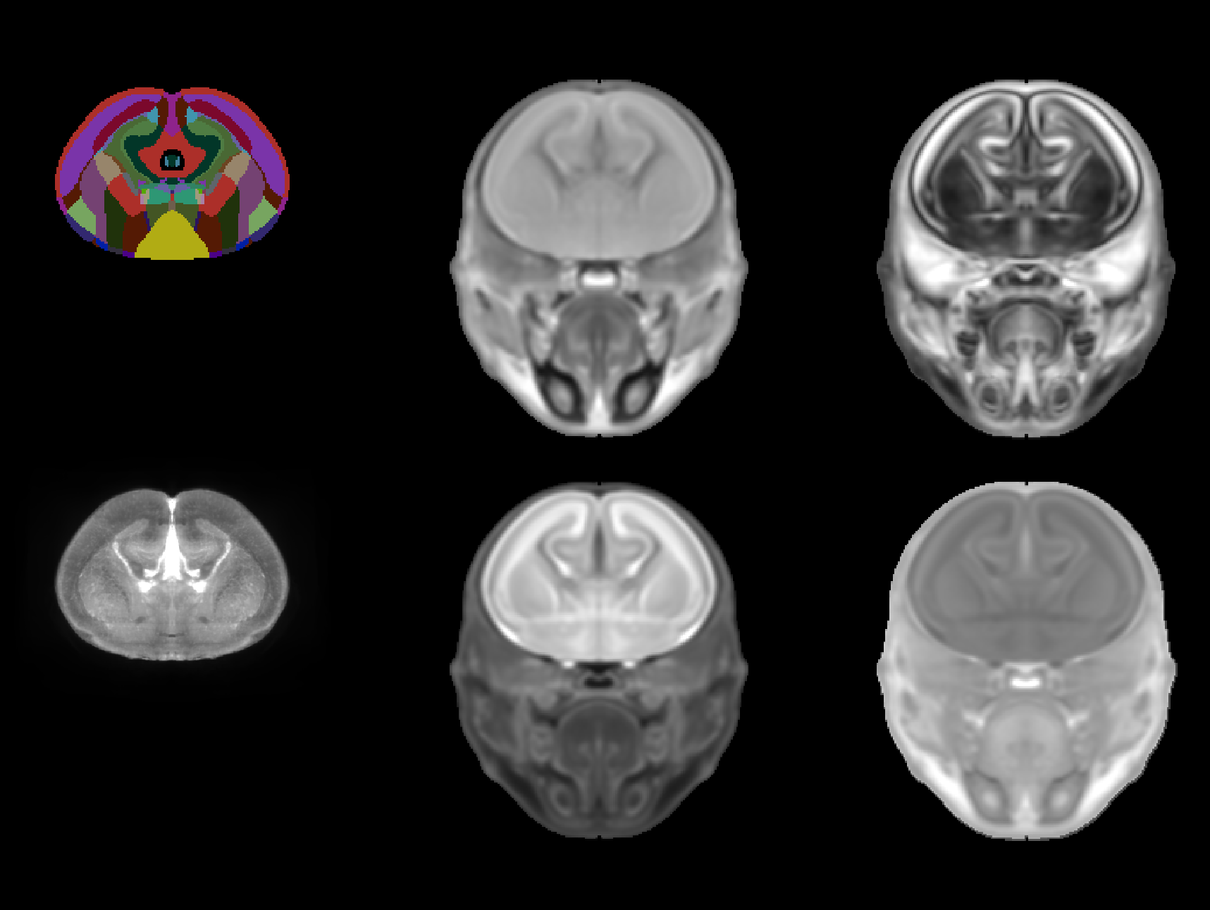 Coronal sections for all templates for Kim DevCCF template at E18.5