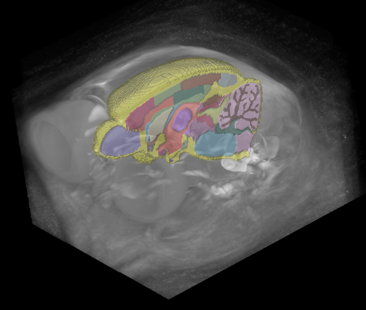 axolotl brain atlas annotations