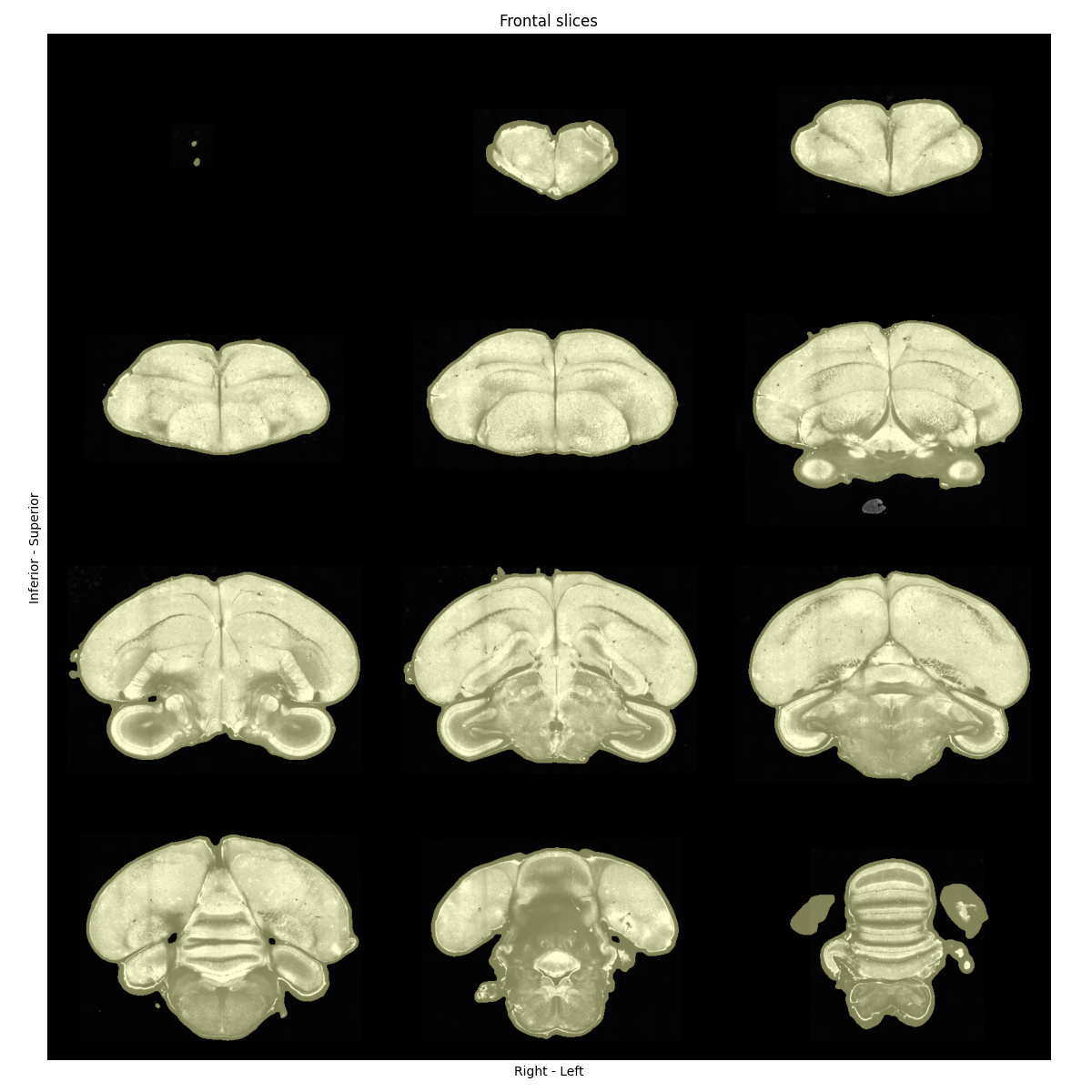 Coronal sections of a zebra finch brain, with nicely fitting masks overlaid