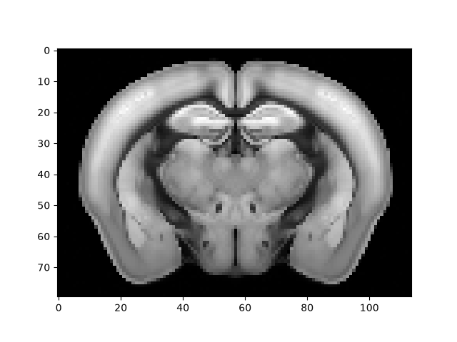 brainglobe atlasapi example