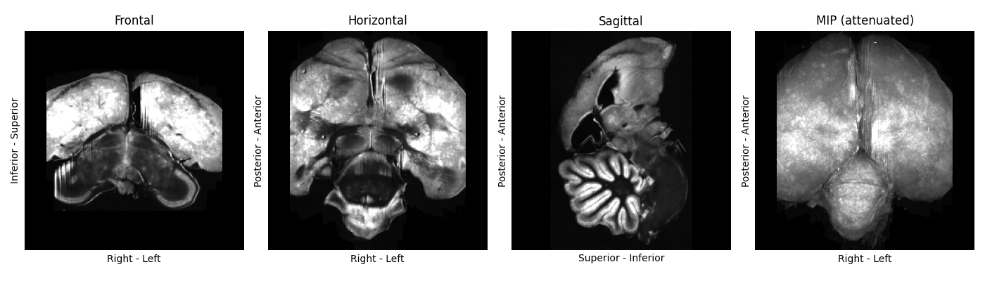 Orthogonal slices and a 3D render of a standardised zebrafinch sample with major parts of the brain cropped