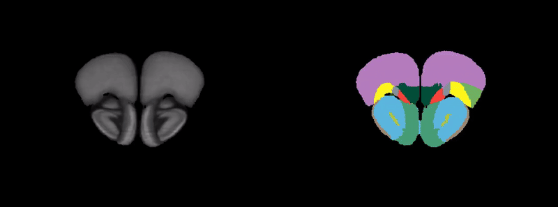 Waxholm SWC female rat atlas